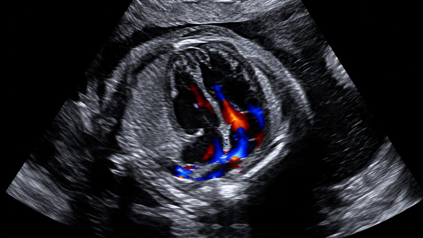 Ecocardiografia Fetal